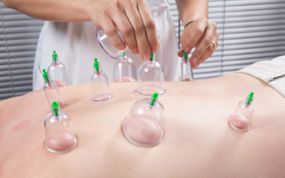 Schröpfmassage für intensive Durchblutungsförderung